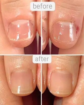 ネイル 自爪育成専門店Ka pilina所属・自爪育成専門店 Kapilinaのエステ・リラクイメージ