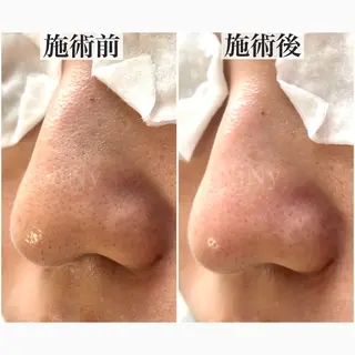 NiNy所属・毛穴ケア専門店 NiNyのエステ・リラクイメージ