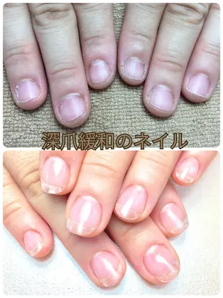 ネイル 深爪矯正/爪育成ケア manie nailのネイルデザイン