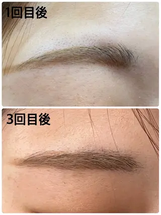アイブロウ みんなの脱毛 TSURURINの眉毛・アイブロウイメージ