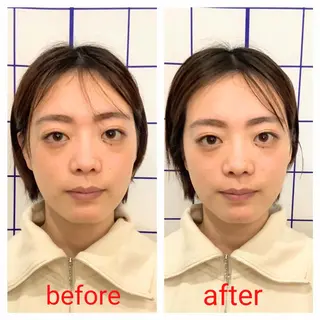 お顔のむくみたるみ 専門☆美容鍼小顔矯正のエステ・リラクイメージ