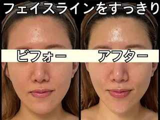 小顔専門看護師クリニカルサロンCOCO所属・小顔と美肌サロン クリニカルサロンココのエステ・リラクイメージ