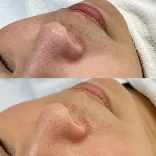 Lei beauty salon所属・松ヤニワックス専門/ 梅田/Leiのエステ・リラクイメージ