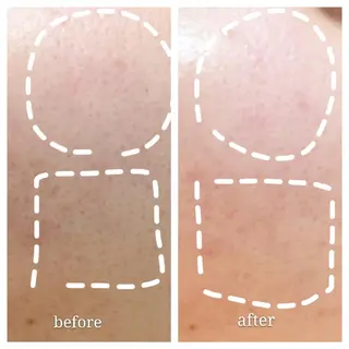 🅖🅤🅩🅔🅛 salonのエステ・リラクイメージ