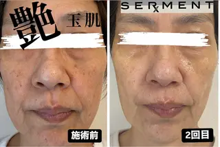 高橋 萌子のマツエク・マツパデザイン