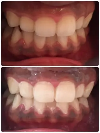 ビューティサロン aiwaのエステ・リラクイメージ