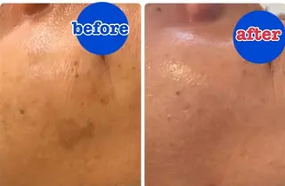 全身脱毛＆VIO脱毛 紹介率№1♪リナ♪のエステ・リラクイメージ