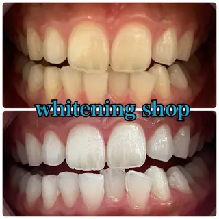 メンズ ホワイトニング ショップ川越店のエステ・リラクイメージ