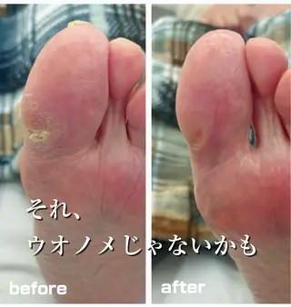 巻き爪フットケアサロンKotori所属・フットケアサロン Kotoriのその他イメージ