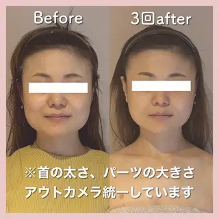 小顔矯正専門店Gémiey所属・越谷駅徒歩３分 小顔専門Gemieyのエステ・リラクイメージ