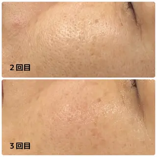 Mia.rosa所属・光フェイシャル・脱毛 MIA.ROSAの眉毛・アイブロウイメージ