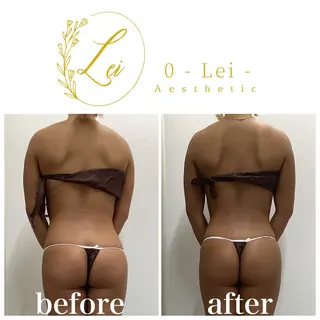 0-Lei-aesthetic所属・レイエステティック スタッフのエステ・リラクイメージ