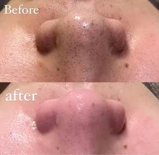 HINA/産毛脱毛・ 肌質改善専門サロンのエステ・リラクイメージ