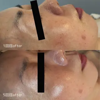 エステティックサロン Liente(リアンテ)所属・Hashimoto .のエステ・リラクイメージ