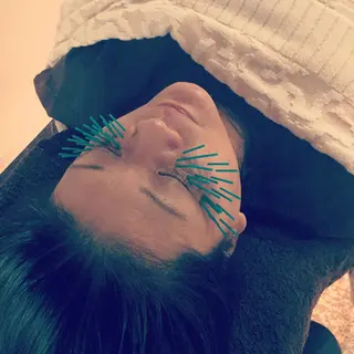 小顔矯正&美容鍼 東洋健美のエステ・リラクイメージ