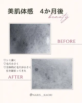 フェイシャルエステ♡ KAORIのエステ・リラクイメージ