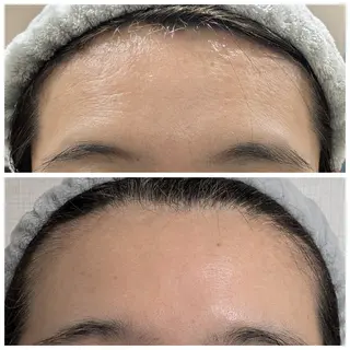 自然由来スキンケア/ 肌質改善/まつパのエステ・リラクイメージ