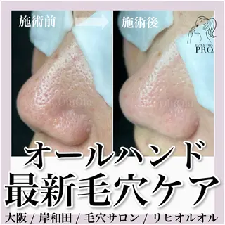 毛穴汚れ改善専門店/ 岸和田/リヒオルオルのエステ・リラクイメージ