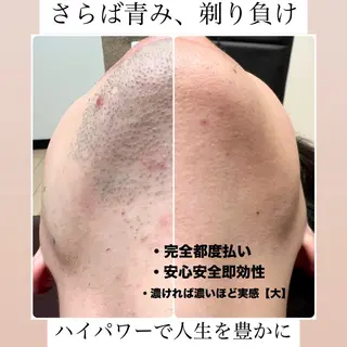 メンズ メンズ脱毛サロン Le falcoのエステ・リラクイメージ