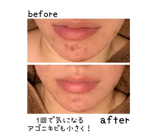 メンズ 癒し腸もみサロン シャユーム　ゆきなのエステ・リラクイメージ