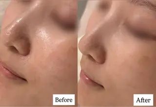 POLA 大阪福島店所属・POLA 大阪福島店のエステ・リラクイメージ