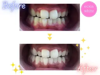 ecxia  white 　広島袋町店所属・セルフホワイトニング エクシア広島袋町店のその他イメージ