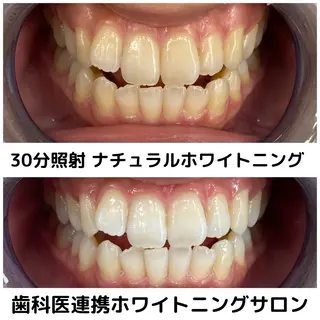 Platinum Beauty 四条烏丸店所属・吉田亮利 ホワイトニング専門店のその他イメージ