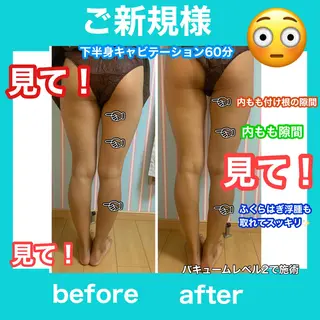 痩身/脱毛/ネイル HARUKAのエステ・リラクイメージ