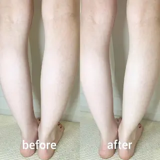 ﾌｪｲｼｬﾙｴｽﾃ ﾗﾄｩｰﾙ伊深のエステ・リラクイメージ