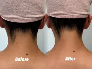 🫧美しい素肌へ🫧 今成柚乃のその他イメージ