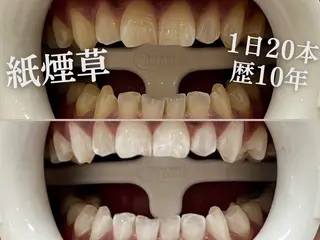 ホワイトニングサロン SARAのエステ・リラクイメージ