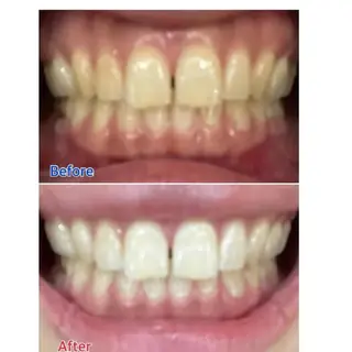 M渋谷店所属・M渋谷 ホワイトニングのその他イメージ