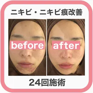 ミディアム カラー パーマ ヘアアレンジ メンズ キッズ ネイル マツエク・マツパ ニキビ・肌質改善専門 ♡人生が変わるサロンのエステ・リラクイメージ