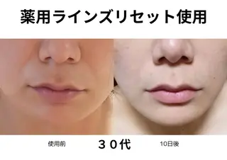 メナードフェイシャルサロン祖父江所属・メナード祖父江 伊藤香織のエステ・リラクイメージ