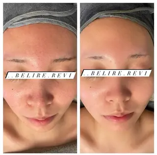 ..Belire.Revi所属・ベリールルヴィ ベリールルヴィのエステ・リラクイメージ