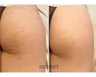 肌質改善🌿 彩也乃のエステ・リラクイメージ