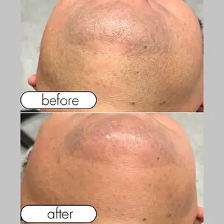 メンズ ＆MoRe.yasu アンドモアヤスのエステ・リラクイメージ