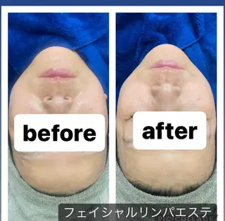 RE:moom リムーム/脱毛エステのエステ・リラクイメージ