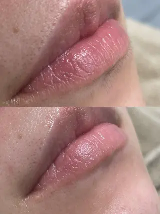 ビューティーサロン Lino🫧mayuのエステ・リラクイメージ