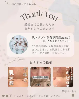 6万人の美肌実績🔥 最短ニキビ改善のエステ・リラクイメージ