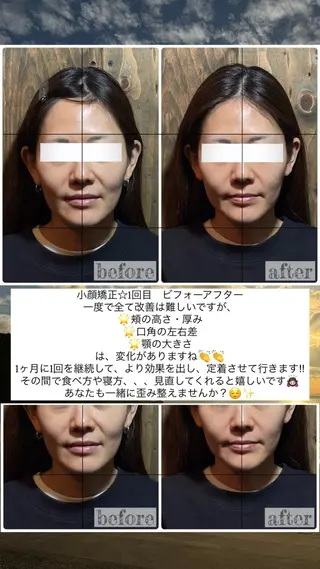 💎後悔させない小顔 矯正💎イトヤマ🌱のエステ・リラクイメージ