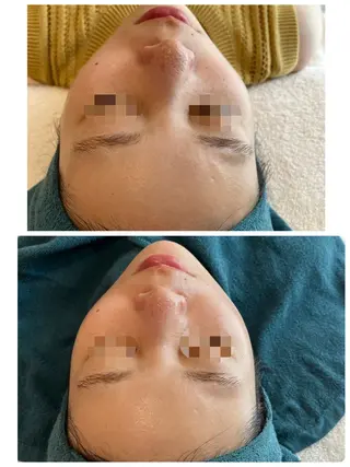 【リベルハーブピーリング認定店】敏感肌・美白脱毛専門店Dione立川店所属・Dione 立川店のエステ・リラクイメージ