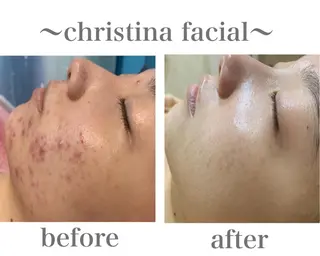 フェイシャル/脱毛 ジョアアンジェ　田中のエステ・リラクイメージ