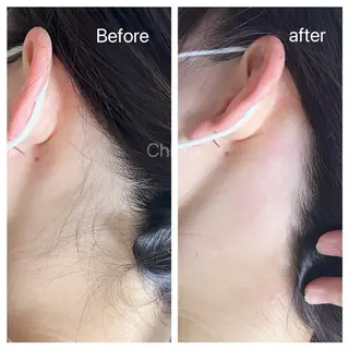 川越ローマピンク 光脱毛＆ワックス脱毛のエステ・リラクイメージ