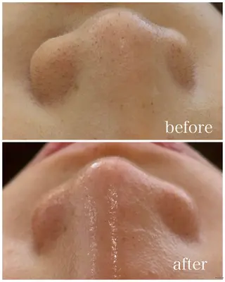 écla【中崎町】 yukikoのエステ・リラクイメージ