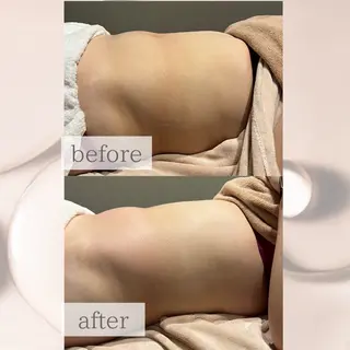 【vidyto】ヴィディトゥ所属・肌管理サロン vidyto　MOEのエステ・リラクイメージ