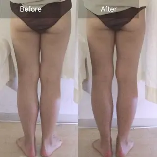 （KIE） 月額エステPRERYのエステ・リラクイメージ