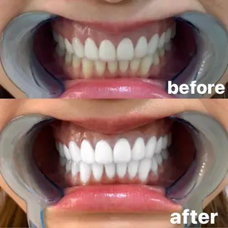 ロング カラー パーマ ヘアアレンジ メンズ キッズ ネイル マツエク・マツパ ライトビューティー 錦糸町店のエステ・リラクイメージ