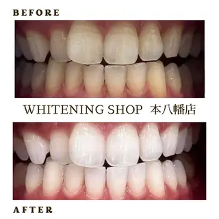 メンズ ホワイトニング ショップ本八幡店のエステ・リラクイメージ