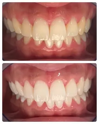 セルフホワイトニング サクッとホワイト   立川店所属・サクッとホワイト 立川店のその他イメージ